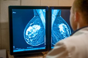 BREAST DIAGNOSTICS (MAMMOGRAPHY)